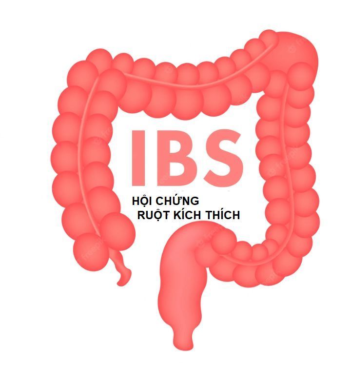 Hội chứng ruột kích thích (IBS)